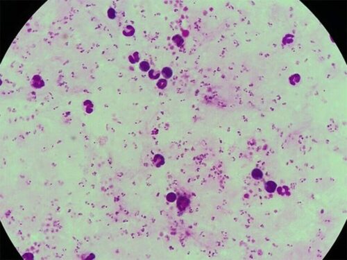 Costa Rica redujo la malaria este año

 – Reporte Tico