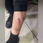 «Pet -Frienitude» sin protocolos: la madre condena a su hijo a su hijo en un centro comercial Pitbull Pitbull

 – Reporte Tico