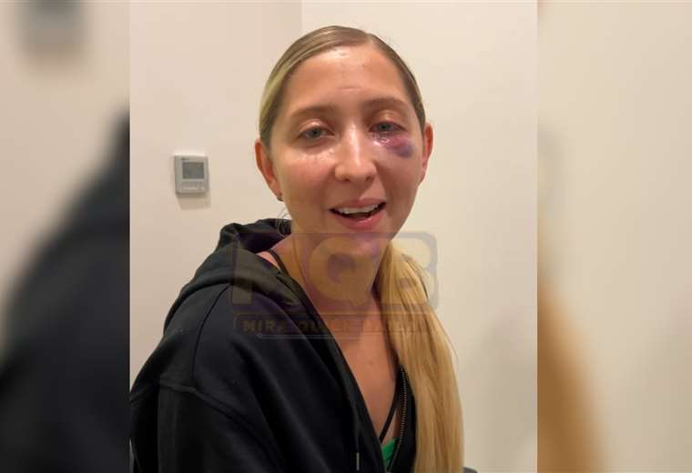 Ballerina Lucía Jiménez: «Dios es muy grande, no me dio en el ojo»

 – Reporte Tico