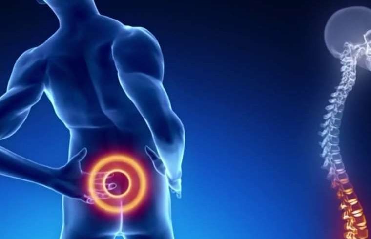 Los dolores de espalda y los problemas de columna van en aumento en Costa Rica, según un nuevo estudio

 – Reporte Tico